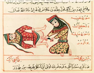 Ms Sup Turc 693 fol.110v Vroedvrouw opereert op een hermafrodiet, 1466